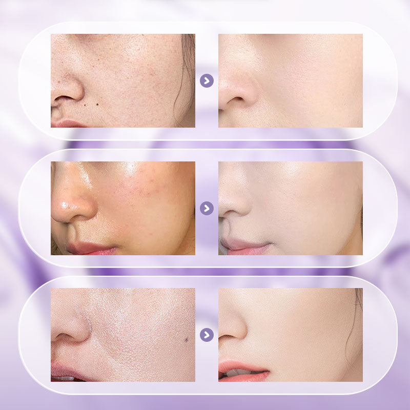 š2025 New UpgradešAll-in-One Niacinamide Cream
