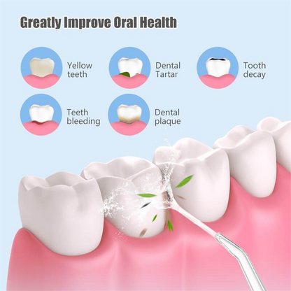✨🦷Portable Oral Irrigator Water Flosser