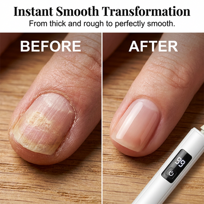 💅Professional Electric Nail Polisher – Smooths thick nails, 99-speed display. Multiple heads for shaping & buffing. 💎